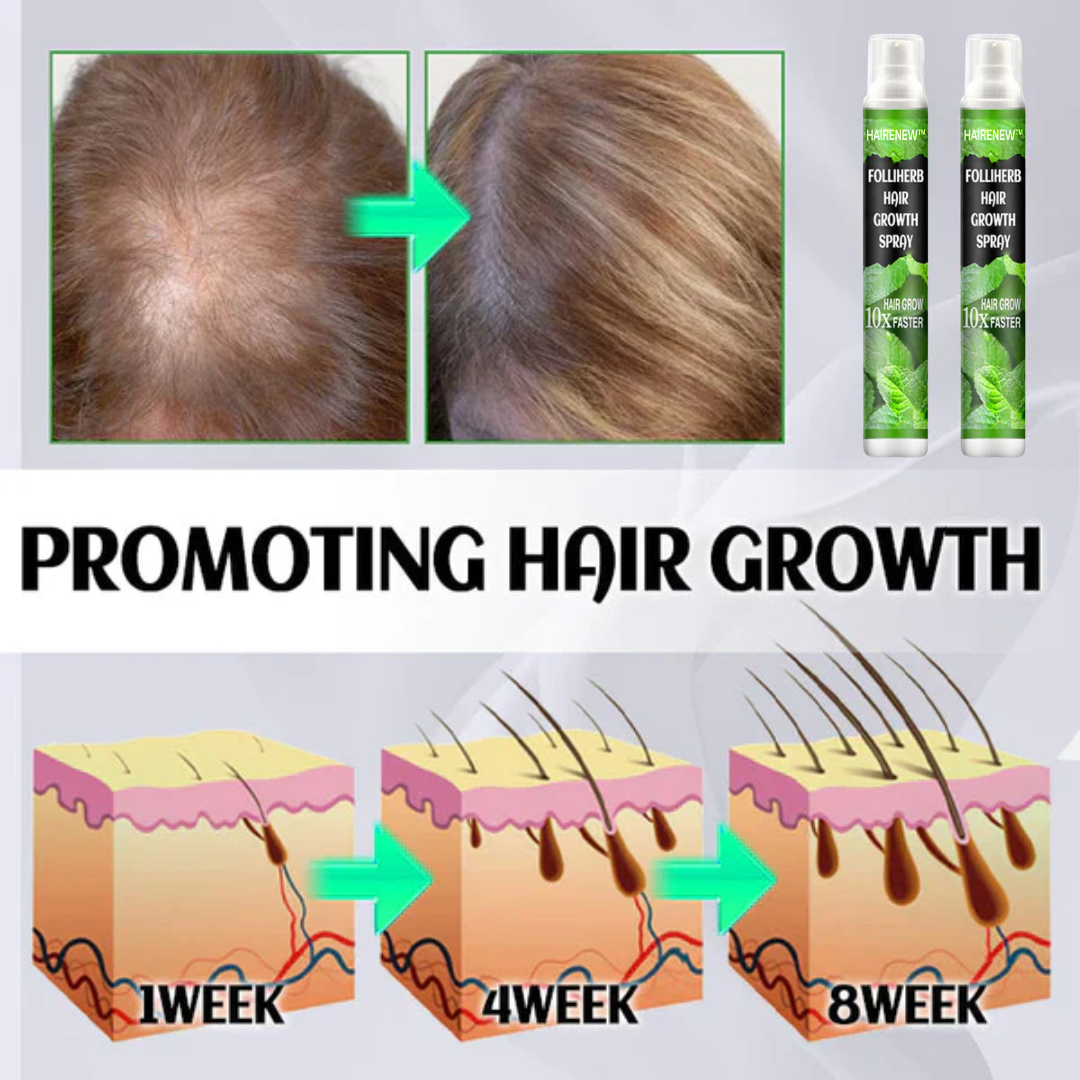 🔥6K units sold per day in the Americas HAIRENEW™ FolliHerb Hair Growth Spray