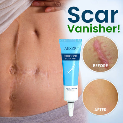 🔥2024 HOT SALE🔥AEXZR™ Silicone Scar Gel